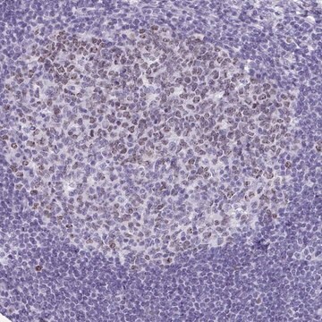 Anti-SUZ12 antibody produced in rabbit Prestige Antibodies&#174; Powered by Atlas Antibodies, affinity isolated antibody, buffered aqueous glycerol solution