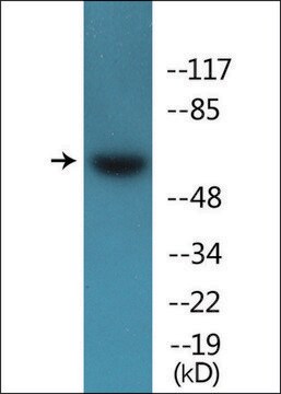 Anti-phospho-Src (pTyr418) antibody produced in rabbit affinity isolated antibody