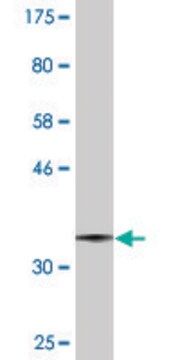 Monoclonal Anti-UGCG antibody produced in mouse clone 1E5, purified immunoglobulin, buffered aqueous solution