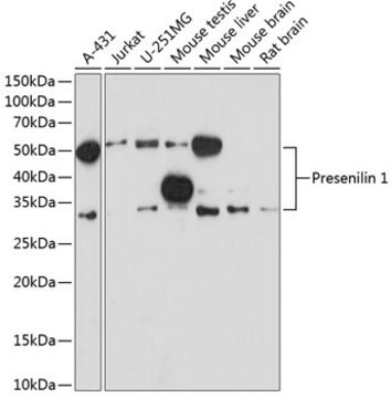 Anti-Presenilin 1 Antibody, clone 3W4V8, Rabbit Monoclonal