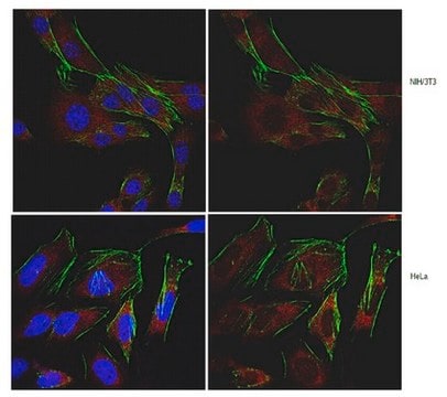 Anti-SDHD (CybS) Antibody from rabbit, purified by affinity chromatography