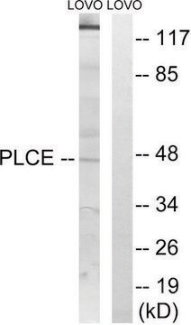 Anti-AGPAT5 antibody produced in rabbit affinity isolated antibody