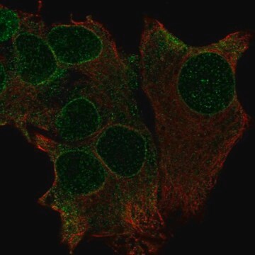 Anti-TRAK1 antibody produced in rabbit Prestige Antibodies&#174; Powered by Atlas Antibodies, affinity isolated antibody