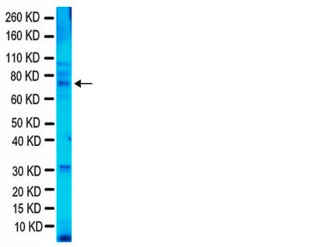 Anti-Fragile-X-Mental-Retardation-Protein-Antikörper, Klon&nbsp;1C3 ascites fluid, clone 1C3, Chemicon&#174;