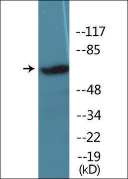 抗 磷酸-IRAK1 (pThr 209 ) 兔抗 affinity isolated antibody