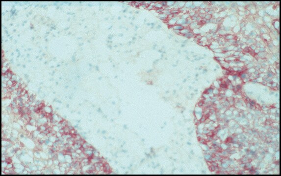 モノクロナール抗上皮成長因子受容体 マウス宿主抗体 clone F4, ascites fluid