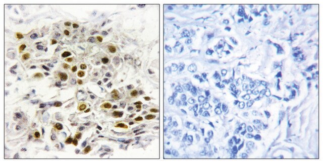 Anti-MAP3K6 antibody produced in rabbit affinity isolated antibody