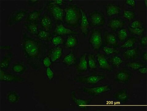 抗 DCP1A 单克隆抗体 小鼠抗 clone 3G4, purified immunoglobulin, buffered aqueous solution