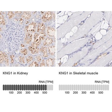 Anti-KNG1 antibody produced in rabbit Prestige Antibodies&#174; Powered by Atlas Antibodies, affinity isolated antibody, buffered aqueous glycerol solution