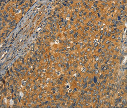 Anti-CIB1 antibody produced in rabbit affinity isolated antibody