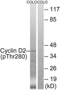 Anti-Cyclin D2 (Phospho-THR280) affinity isolated antibody