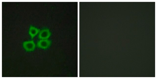 Anti-CRHR2 antibody produced in rabbit affinity isolated antibody