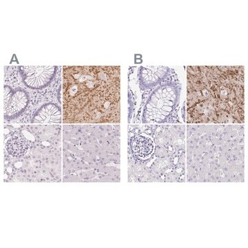 Anti-SYNPR antibody produced in rabbit Prestige Antibodies&#174; Powered by Atlas Antibodies, affinity isolated antibody, buffered aqueous glycerol solution