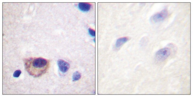 Anti-ATPASE antibody produced in rabbit affinity isolated antibody