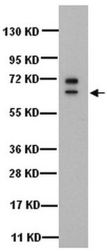 Anti-Zytokeratin&nbsp;5-Antikörper, 6, Klon D5/16B4 clone D5/16B4, Chemicon&#174;, from mouse