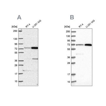 抗PES1抗体 ウサギ宿主抗体 Prestige Antibodies&#174; Powered by Atlas Antibodies, affinity isolated antibody