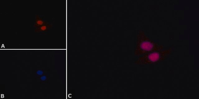 Monoclonal Anti-p53&#8722;Biotin in Maus hergestellte Antikörper ~1&#160;mg/mL, clone DO-1, ascites fluid, buffered aqueous solution