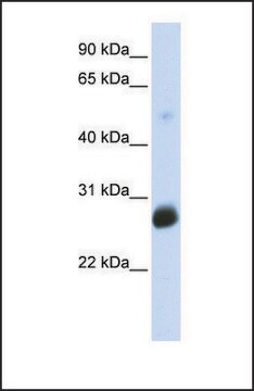 Anti-RNF186 antibody produced in rabbit affinity isolated antibody