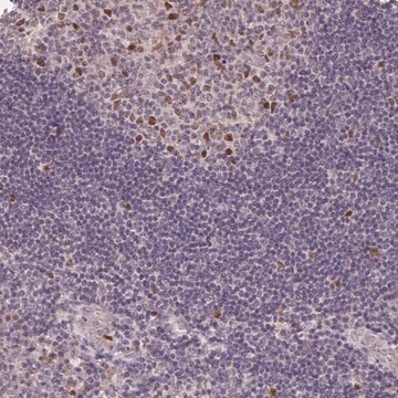 Anti-KIFC1 antibody produced in rabbit Prestige Antibodies&#174; Powered by Atlas Antibodies, affinity isolated antibody, buffered aqueous glycerol solution