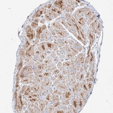 Anti-MTX2 antibody produced in rabbit Prestige Antibodies&#174; Powered by Atlas Antibodies, affinity isolated antibody, buffered aqueous glycerol solution, ab1