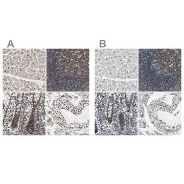 抗USP28抗体 ウサギ宿主抗体 Ab2, Prestige Antibodies&#174; Powered by Atlas Antibodies, affinity isolated antibody, buffered aqueous glycerol solution