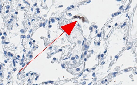 Anti-ACE2-cytoplasmic Antibody, clone 1C17 ZooMAb&#174; Rabbit Monoclonal recombinant, expressed in HEK 293 cells