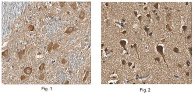 Anti-Neuroglobin Antibody, clone 6G1.1 clone 6G1.1, from mouse