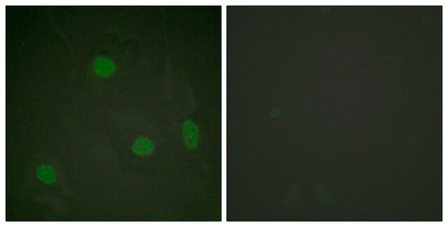 Anti-Histone H3 (Acetyl-Lys23) antibody produced in rabbit affinity isolated antibody