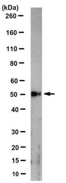 Anti-Vitamin D3 Receptor Antibody, clone 6F3.1 clone 6F3.1, from mouse