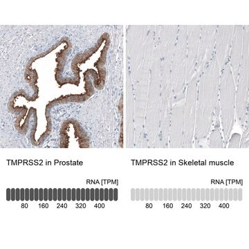 Anti-TMPRSS2 antibody produced in mouse Prestige Antibodies&#174; Powered by Atlas Antibodies, clone CL12511, purified by using Protein A, buffered aqueous glycerol solution