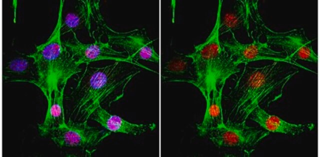 Anti-MDC1 Antibody, clone P2B11 clone P2B11, from mouse