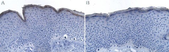 Anti-Filaggrin Antibody, clone AHF7