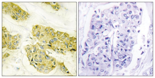 Anti-Collagen V &#945;3 antibody produced in rabbit affinity isolated antibody