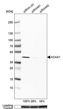 Monoclonal Anti-ACAA1 antibody produced in mouse Prestige Antibodies&#174; Powered by Atlas Antibodies, clone CL2650, purified immunoglobulin, buffered aqueous glycerol solution