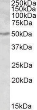 Anti-ALDH9A1 antibody produced in goat affinity isolated antibody, buffered aqueous solution