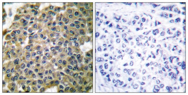 Anti-Keratin 7 antibody produced in rabbit affinity isolated antibody