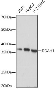 Anti-DDAH1 Antibody, clone 1Q5F6, Rabbit Monoclonal