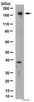 Anticorps anti-CFTR, a.a. 1370-1380, clone M3A7 clone M3A7, Chemicon&#174;, from mouse