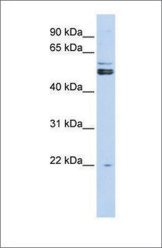 Anti-PRMT2 antibody produced in rabbit affinity isolated antibody