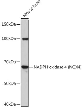 Anti-NADPH oxidase 4 (NOX4) Antibody, clone 6Q3U8, Rabbit Monoclonal