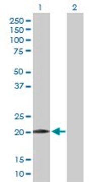 Anti-WWOX antibody produced in mouse purified immunoglobulin, buffered aqueous solution