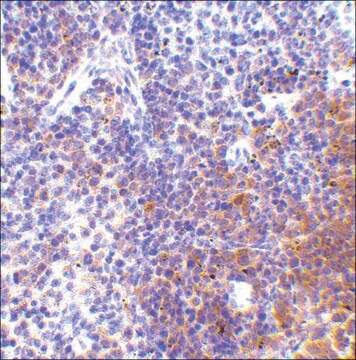 Anti-IRF7 (ab1) antibody produced in rabbit affinity isolated antibody, buffered aqueous solution