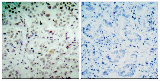 Anti-phospho-RB1 (pSer780) antibody produced in rabbit affinity isolated antibody