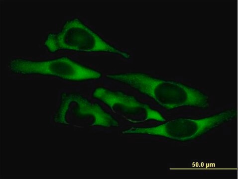 Anti-QARS antibody produced in mouse purified immunoglobulin, buffered aqueous solution