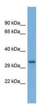 Anti-TAMM41 (C-terminal) antibody produced in rabbit affinity isolated antibody