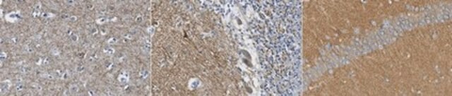 Anti-GluR2 Antibody, clone 14C12.2 clone 14C12.2, from mouse