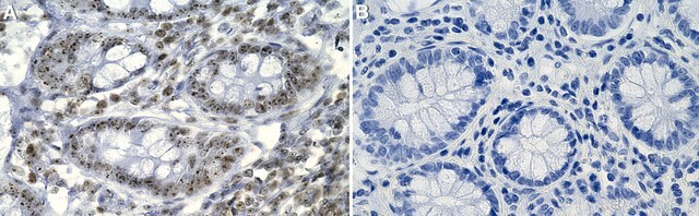 Anti-Fibrillarin/FBL Antibody, clone 1G19 ZooMAb&#174; Rabbit Monoclonal recombinant, expressed in HEK 293 cells