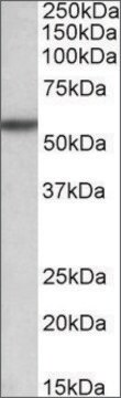 Anti-TGFBR1 antibody produced in goat affinity isolated antibody, buffered aqueous solution