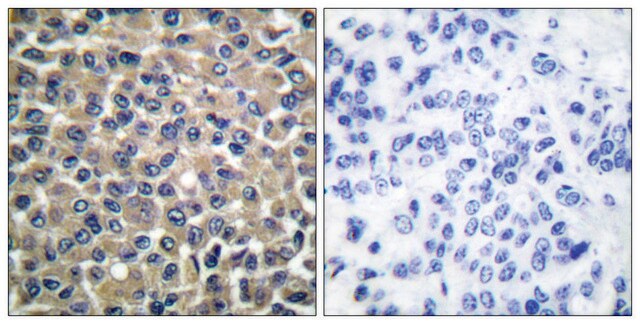 Anti-MMP-19 antibody produced in rabbit affinity isolated antibody