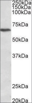 Anti-CACNB2 (C-terminal) antibody produced in goat affinity isolated antibody, buffered aqueous solution